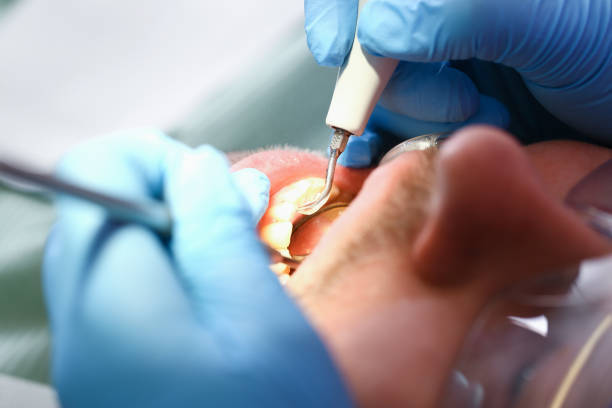 Best Emergency Treatment for Jaw Pain or Injury in State College, PA